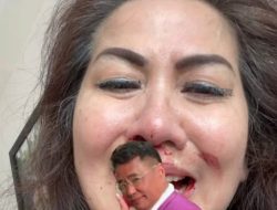 Hotman Paris Bela Venna Melinda Sebut Akan Melawan Pengacara Yang Sudah Cerai Tiga Kali